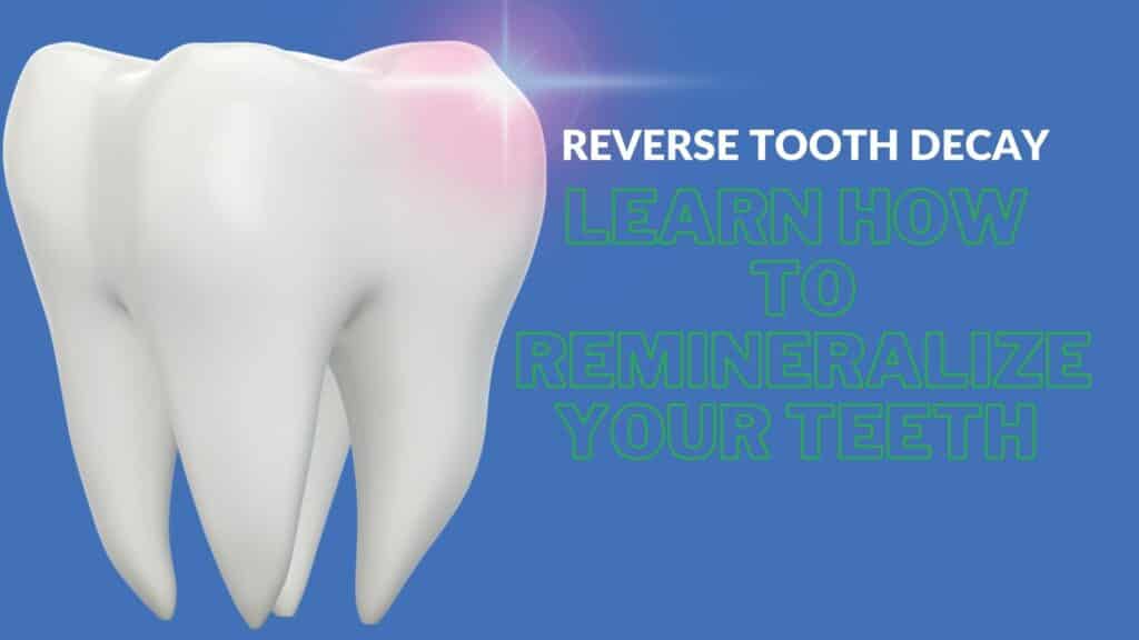 Can One Rotten Tooth Affect Others? Exploring the Connection Between Dental  Health and Overall Wellness