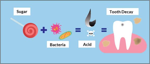 what causes cavities