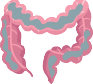 colon cancer