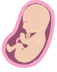 fetal death