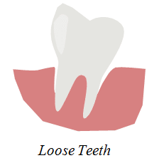loose teeth