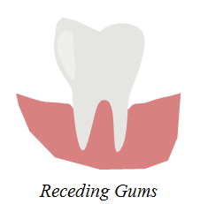 receding gums