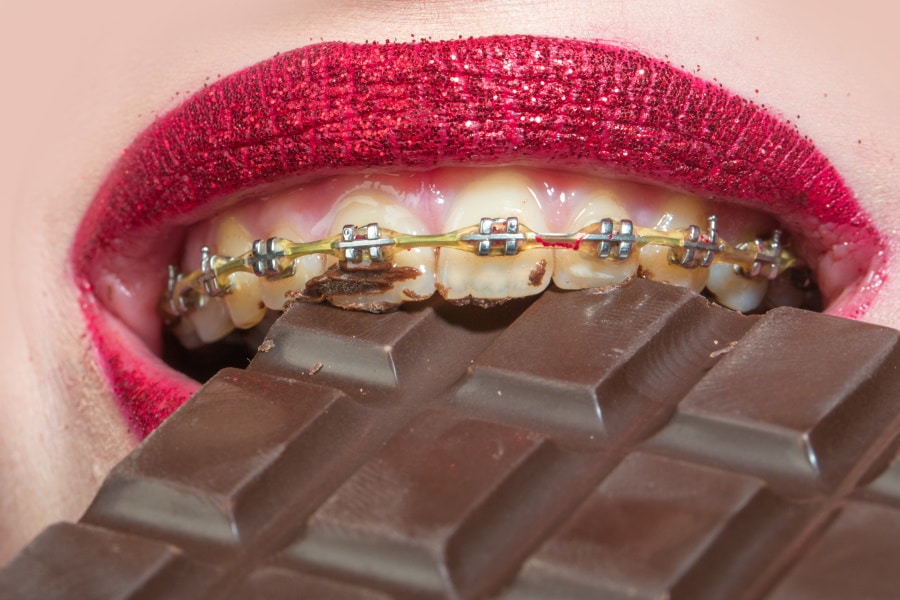 dirty braces causing cavities