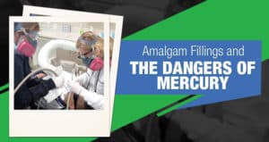 The dangers of amalgam fillings