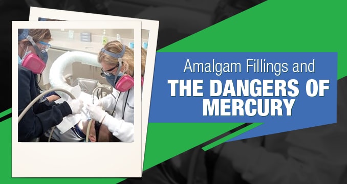 The dangers of amalgam fillings