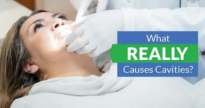 What Causes Cavities
