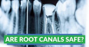 Are root canals safe?