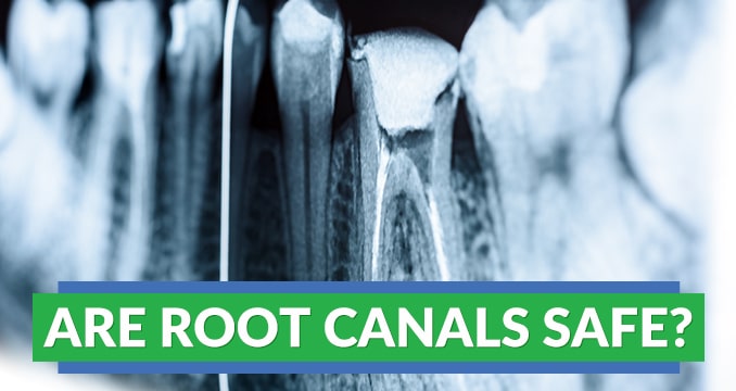 Are root canals safe?