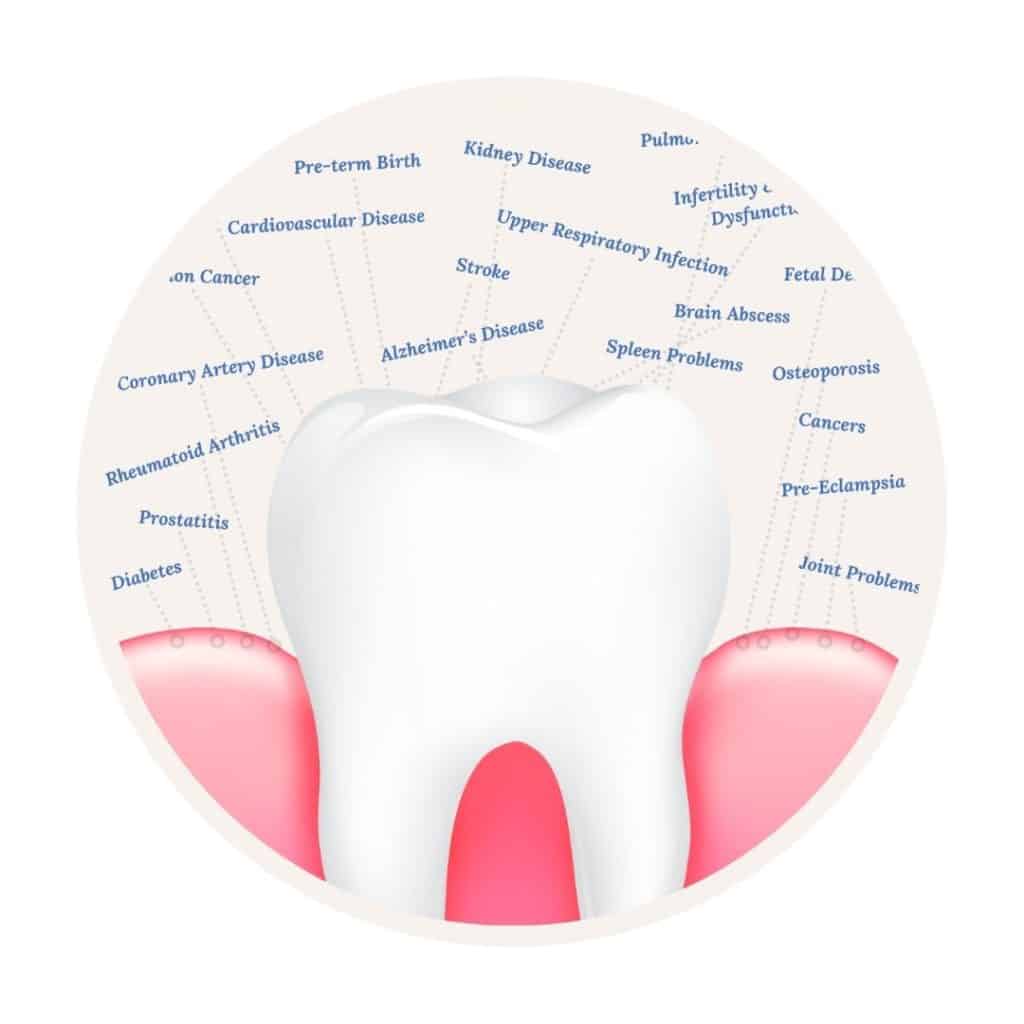 Gum disease leads to many health problems