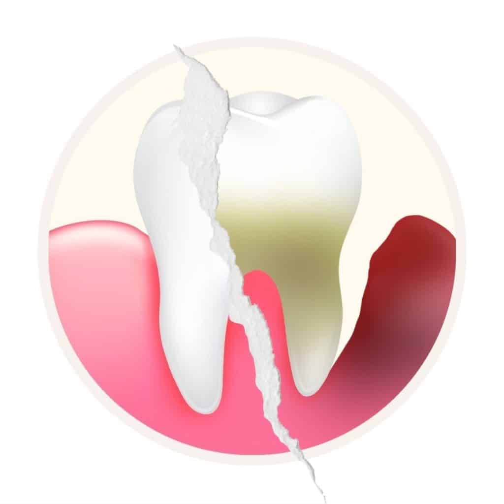 affect of gum disease