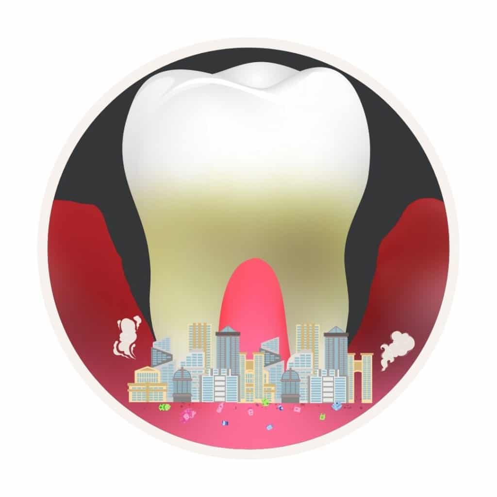 rapid bacteria growth on teeth