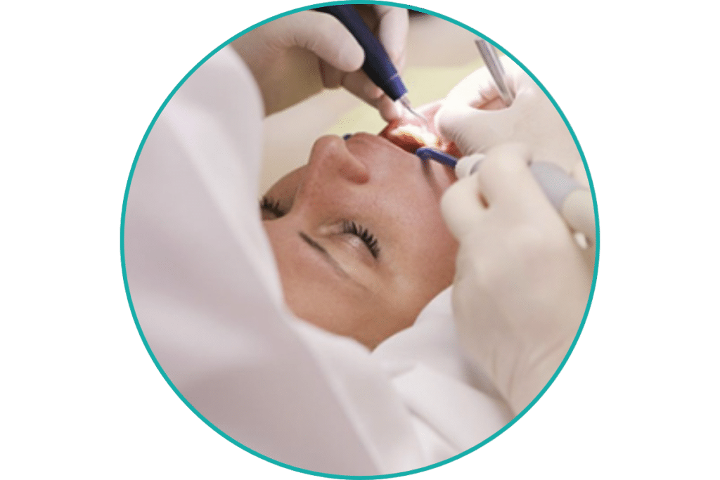 What are Dental Cavitations?