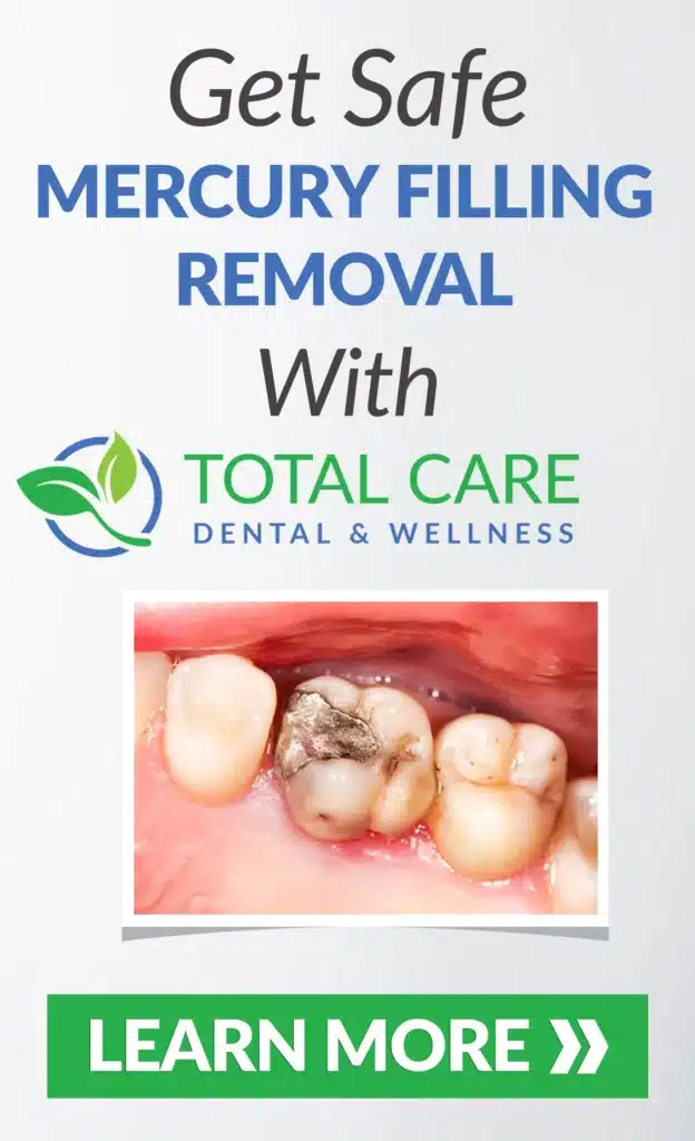 mercury fillings removal vertical ad