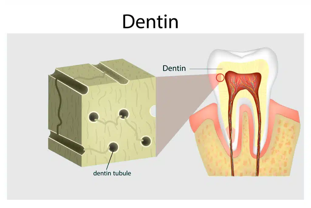 Dentin Tubules inside of a natural tooth