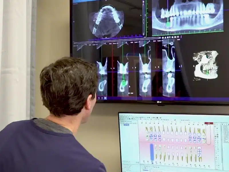 cone beam cbct