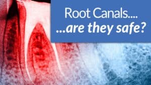 are root canals bad for you?