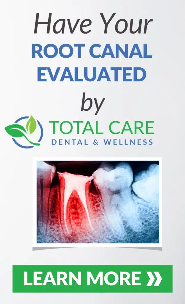 root canal vertical ad