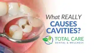 WHAT REALLY CAUSES CAVITIES THUMBNAIL